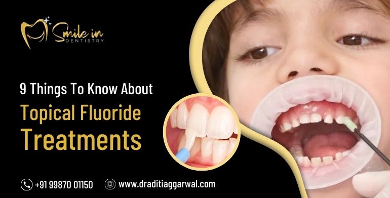 topical fluroide treatment