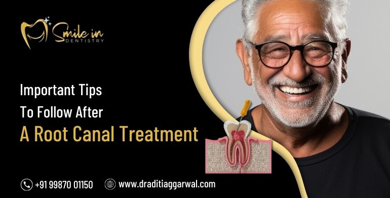 Root Canal Treatment