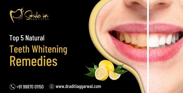 Natural Teeth Whitening Remedies
