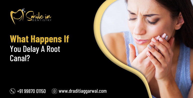 What happens if you delay a root canal?