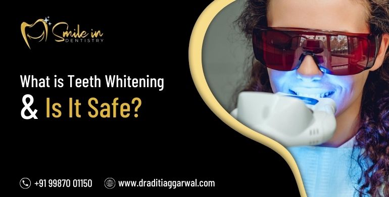 teeth whitening